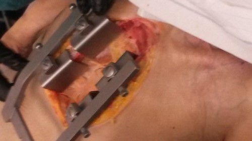 Kryonik Biostase Biostasis