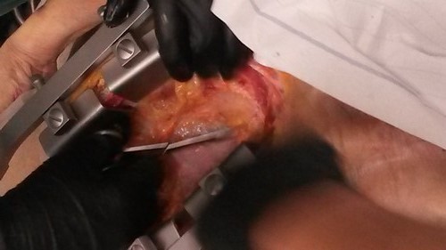 Kryonik Biostase Biostasis