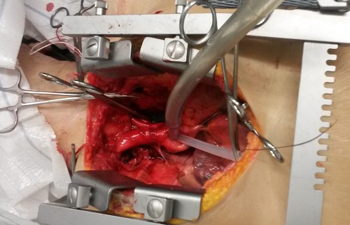 Kryonik Biostase Biostasis