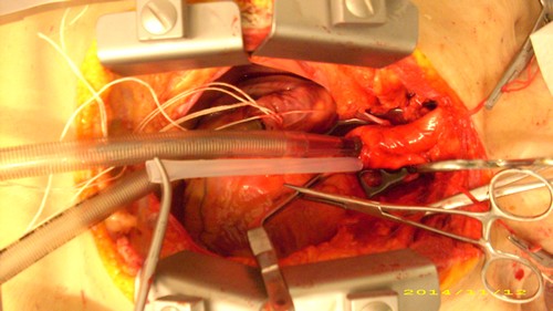 Kryonik Biostase Biostasis