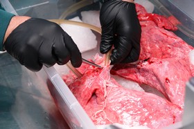 Kryonik Biostase Biostasis