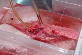 Kryonik Biostase Biostasis